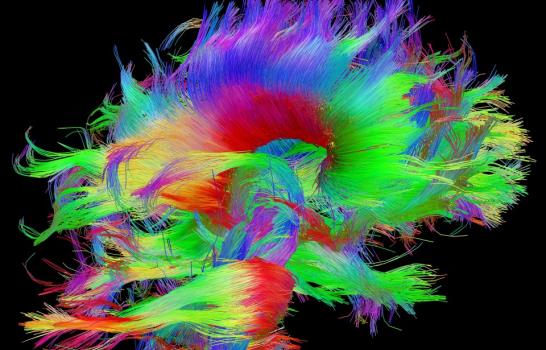 Descifran poco a poco los misterios del cerebro