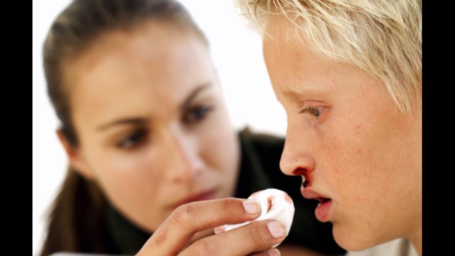 ¿Por qué sangramos por la nariz?