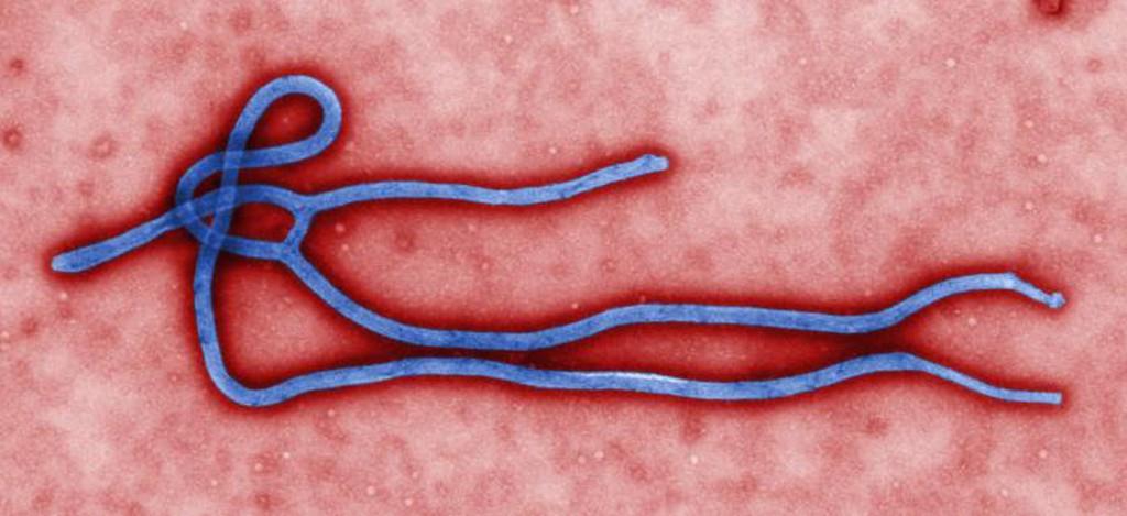 Estudio muestra que nueva vacuna contra el ébola es segura