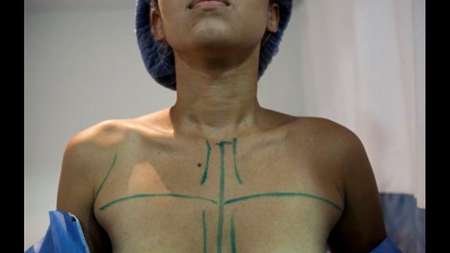 Denuncian falsos cirujanos plásticos en República Dominicana