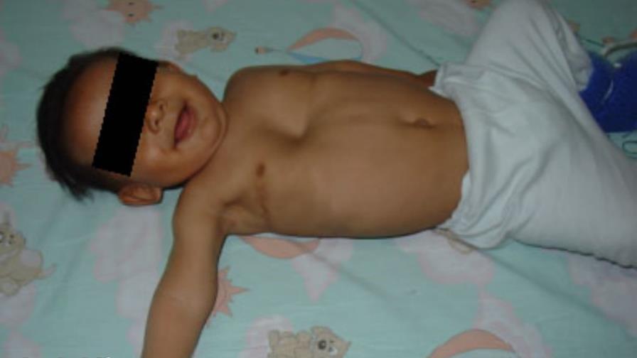 Un acto a sobrevivientes males congénitos Un acto a sobrevivientes males congénitos