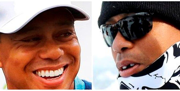 Tiger Woods relata el contratiempo que le costó un diente